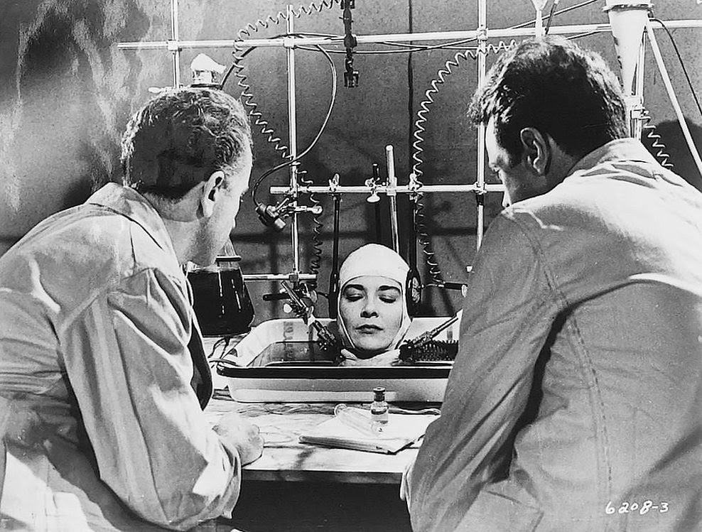 07/29/13 head transplants